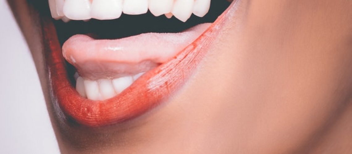 הלבנת שיניים- האם זה באמת אפשרי